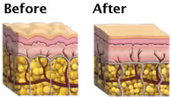before and after image of skin