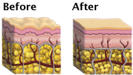 before and after image of skin